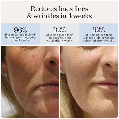 Lumera light therapy mask